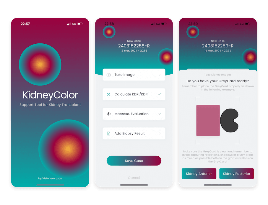 KidneyColor